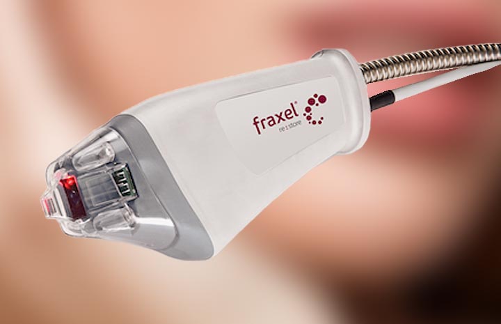 Handstück des Fraxel re:store DUAL Lasers mit Behandlungsfenster und Lichtleiter