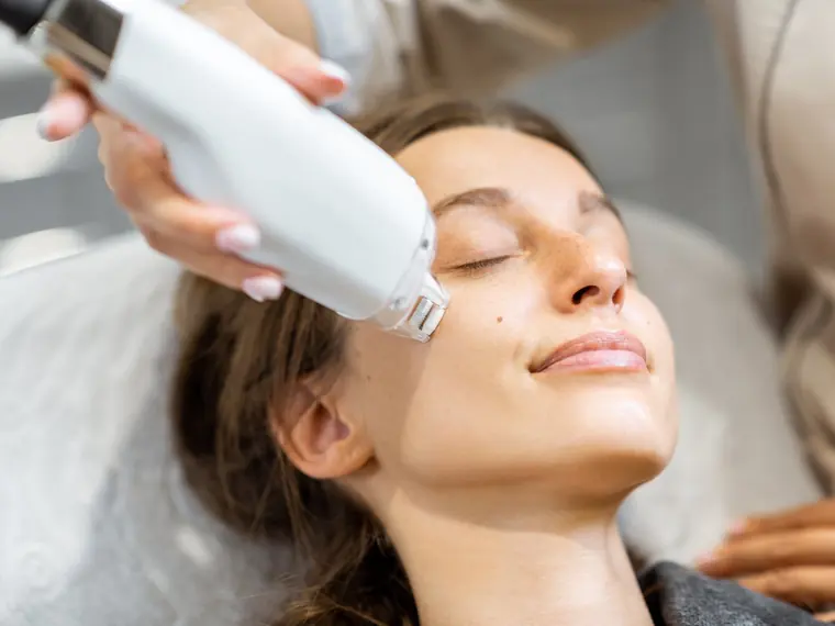 Ästhetische Laserbehandlung im Gesicht bei Skinchic.Med in Hörbranz